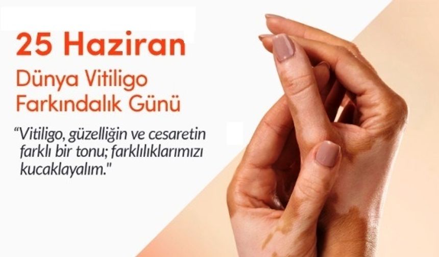 Toplumda Farkındalık Artıyor